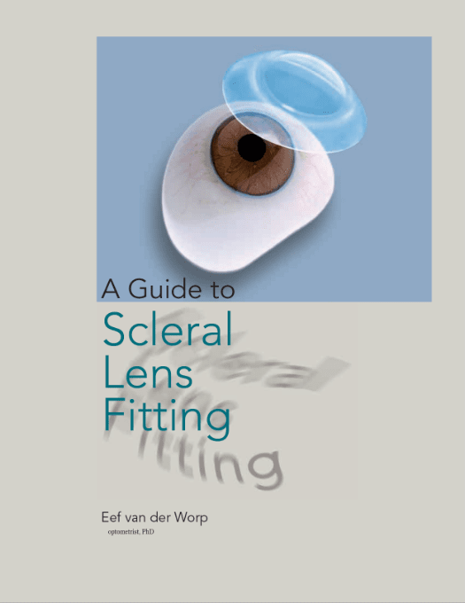 guide scleral lens