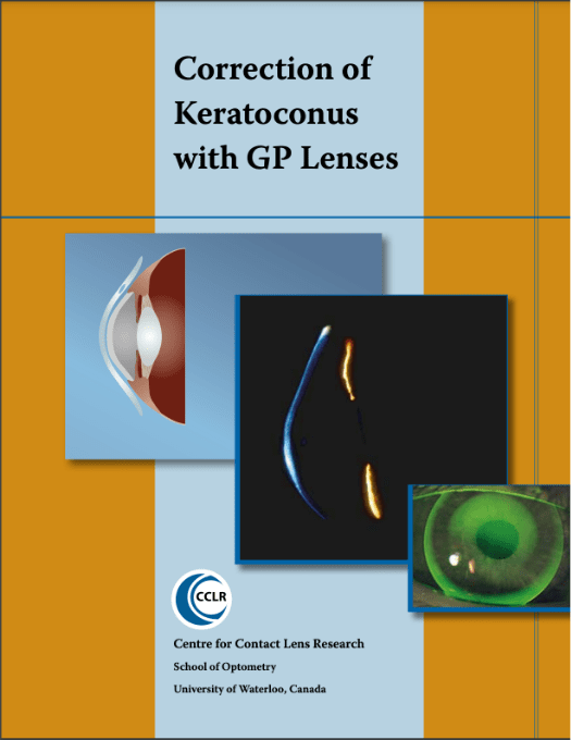 guide scleral lens